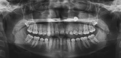 dvt-kfo-3.jpg